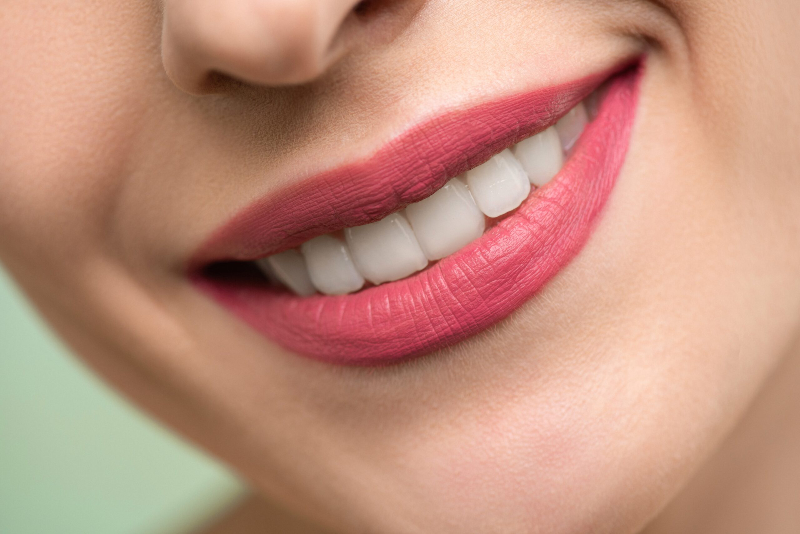 best teeth whitening belfast