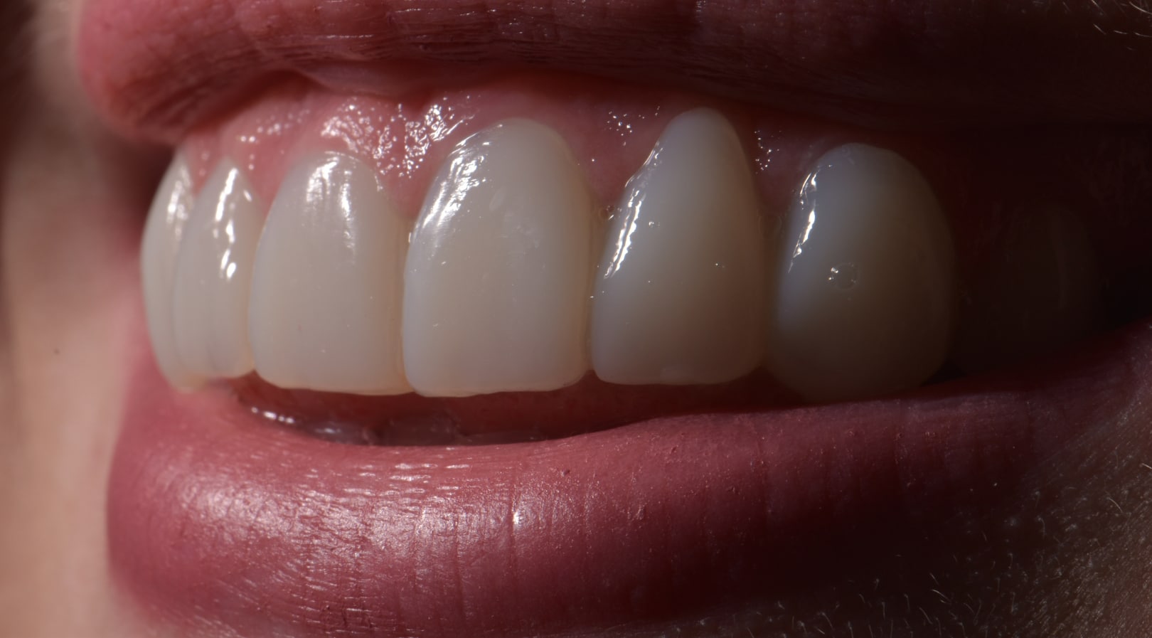 ABC Principle Belfast | Gransha Dental
