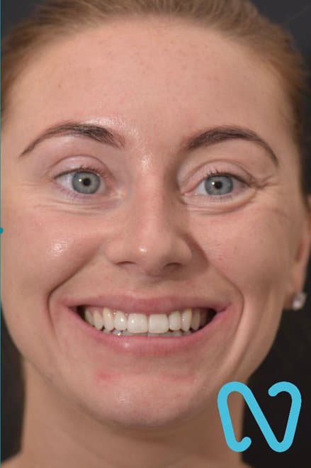 Close-up portrait of a woman smiling after dental treatment