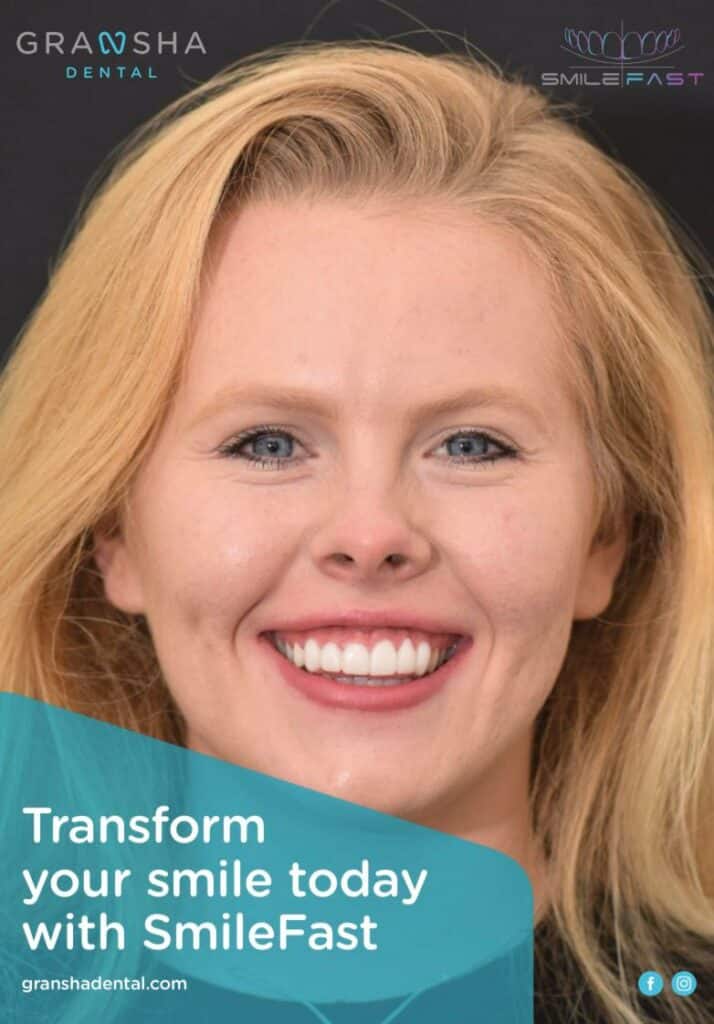 Before and after smile makeover treatment